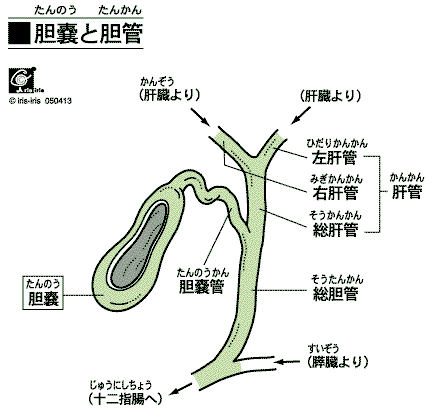 大阪心斎橋のエルンテ整体　胆嚢炎　胆石